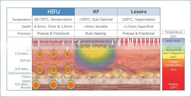 Hifu made in Korea hifu/ hifu factory price / hifu beauty equipment