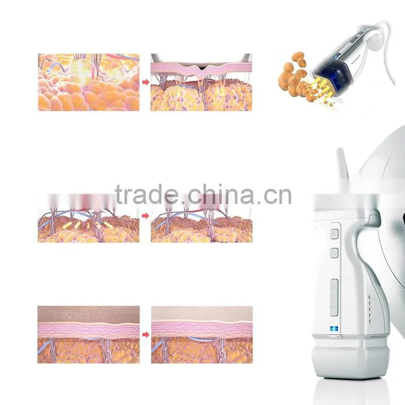 Made in china body slimming beauty machine for face lifting