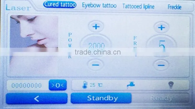 home use hot cakes nd yag laser tattoo removal machine