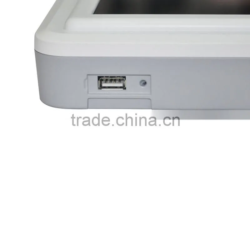 RUS-8000A Handheld veterinary B/W B ultrasound machine with high resolution and USB interface-Shelly