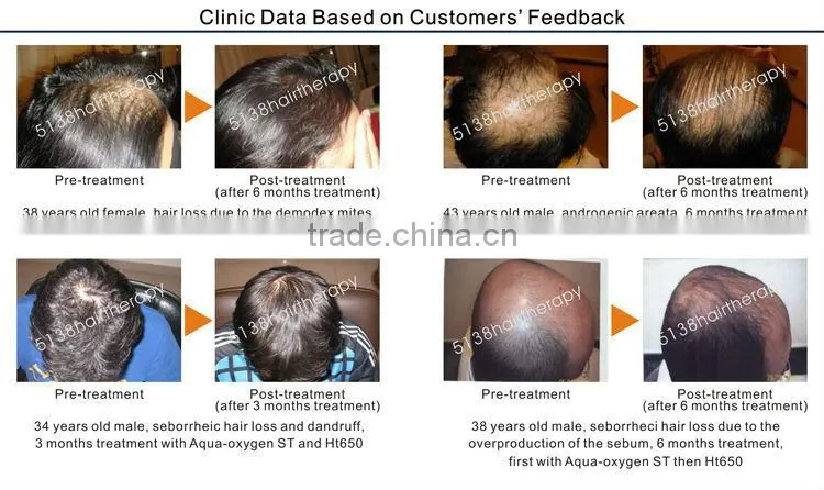 2015 Laser Led Fast Safe Hair Regrowth Beauty Salon Equipment Hair Loss Treatment Hair Regrowth Ht650