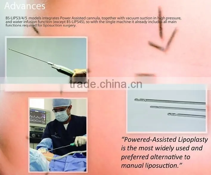 Professional Tumescent Liposuction surgical liposuction Slimming Body Lifting Machine
