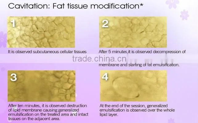 5 in 1 ultrasonic cavitation for beauty salon use