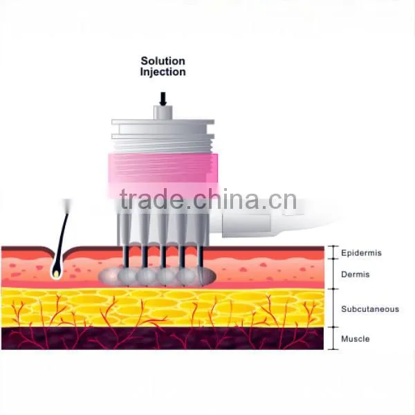 Professional Mesogun Injector for Hair Pore Shrink and Neck Wrinkle Improvement