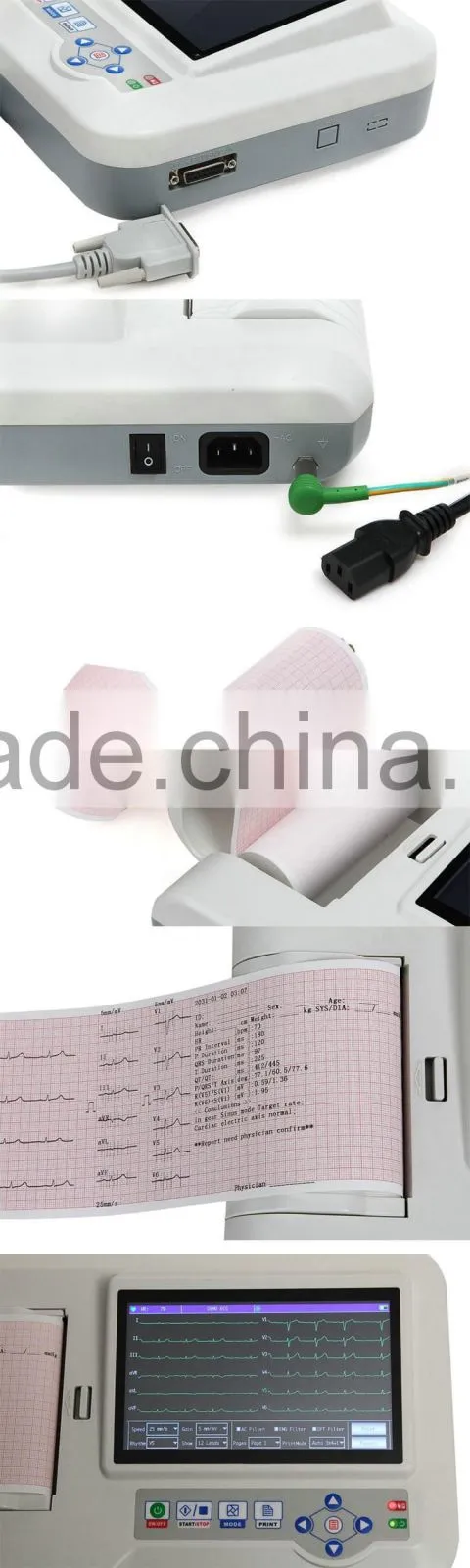 2016 New arrival 6 Channel ECG Monitor cheap price of ecg machine for sale
