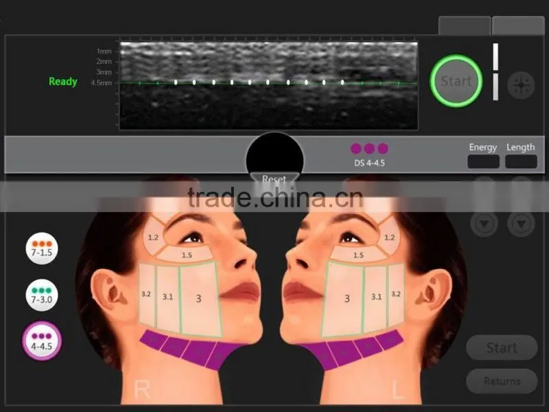 WF-32 Hifu high intensity focused ultrasound