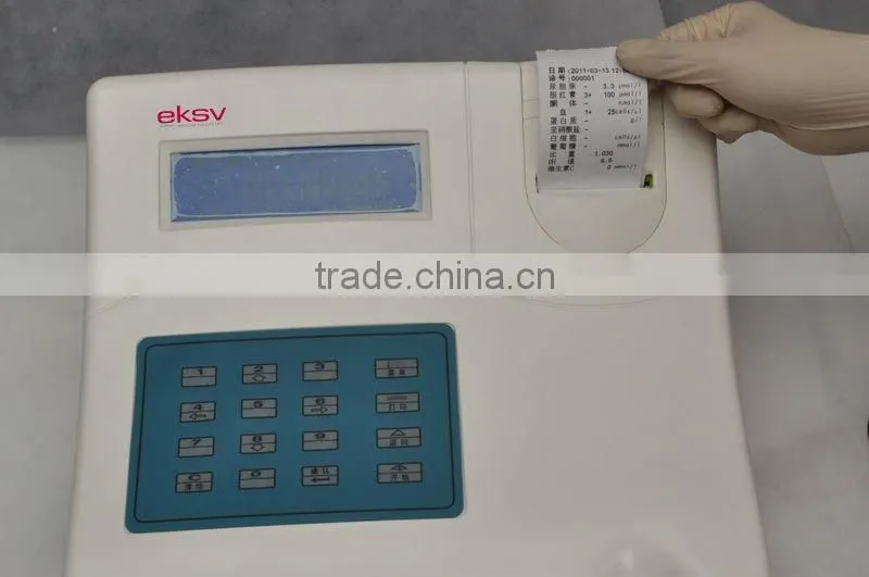 Semi-automated Urine Analysis