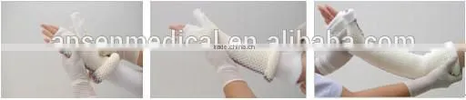 High Rigidness Fast Hardening Medical Polyester Orthopedic Cast Socket/Sleeve Casting