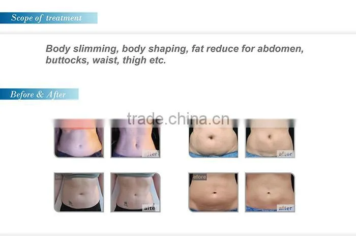 PROMOTION!New beauty for 2015 High Quality Ultrasonic wave slim HIFU Slimming machine