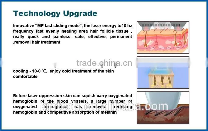 High power 808nm diode laser epilation desktop machine permanent hair removal laser diode laser