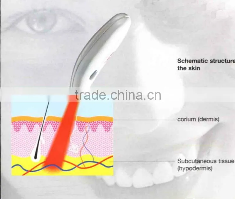 mini ance soft laser pen ance treatment device