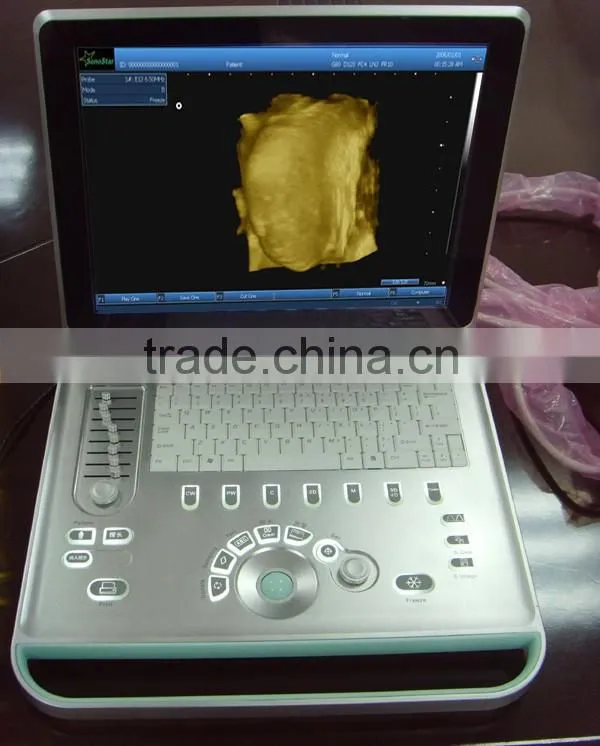 Sonostar hospital veterinary equipment B model ultrasound machine for sale V9