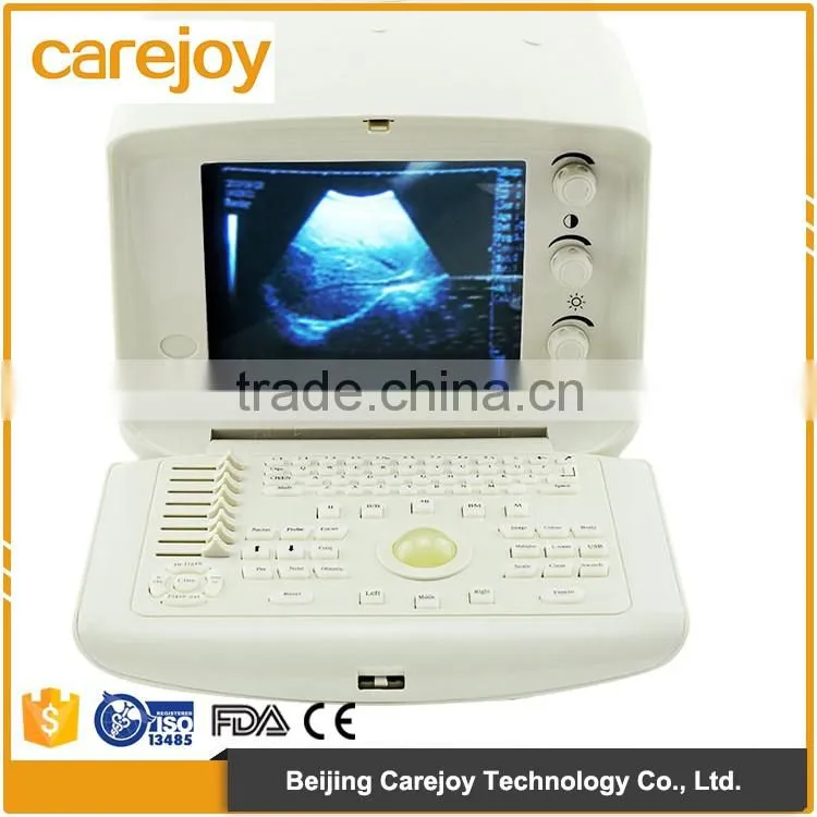 White+Bule wholesale Medical Supplier digital Ultrasound Machine for Pregnancy