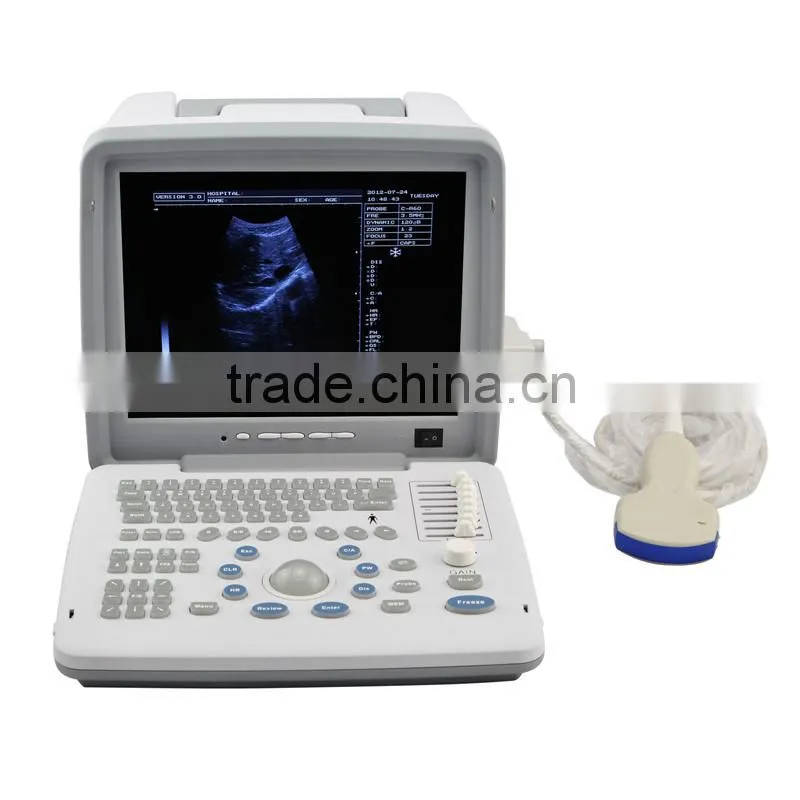 CE approved Laptop/Portable Ultrasound Scanner with 3.5Mhz multi-frequency convex probe