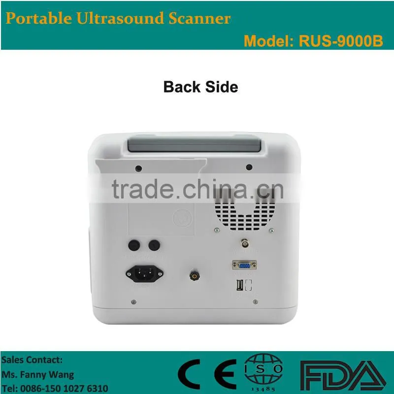 Factory price!CE approved Notebook B-Mode Ultrasound Scanner with 3.5Mhz multi-frequency convex probe RUS-9000B