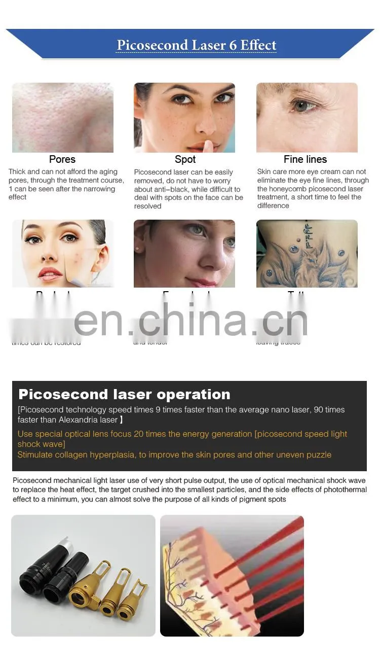 Big Sale Picosecond Laser Birthmark/Tattoo Removal Machine with Powerful Energy