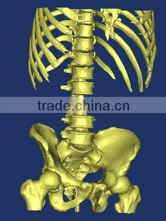 New Automatic Digital 3D Scanner