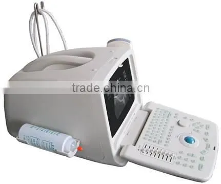 MCSS-6Portable Ultrasound Scanner portable ultrasound machine color dopler
