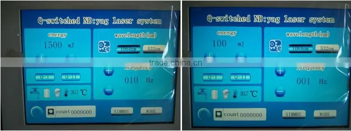 Q-switch Laser ND YAG for Tattoo Removal/laser yag