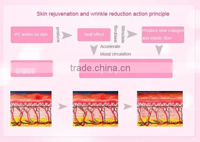 Laser skin machine hair removal device for permanent hair removal skin rejuvenation and acne clearance with 3 lamps