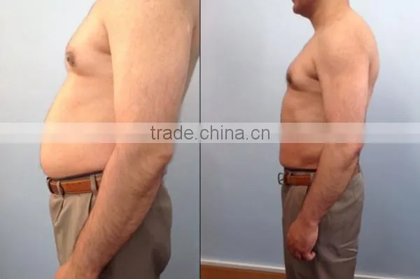 Keep slim hifu beauty machine high intensity focused ultrasound hifu