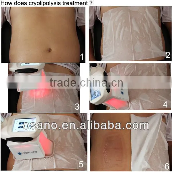 3 cryo handles for different treatment area,quick freezing machine,cryolipolysis fat freeze slimming machine