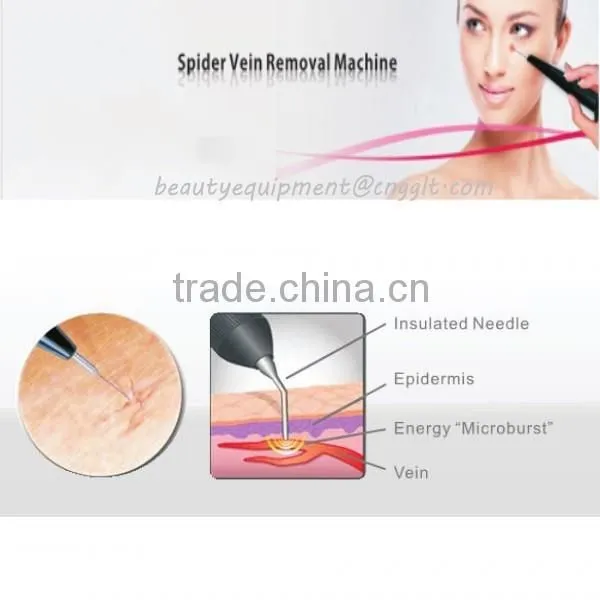 Professional RBS spider vein removal machine with best treatment effect