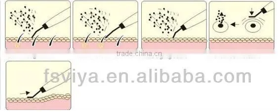 VY-Q07 Diamantadas Dermoabrasion Personal Protective Facial Tool Equipment Beauty Salon