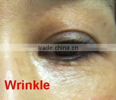 Bonni eye care system with unqie technology combine cosmetic better effect