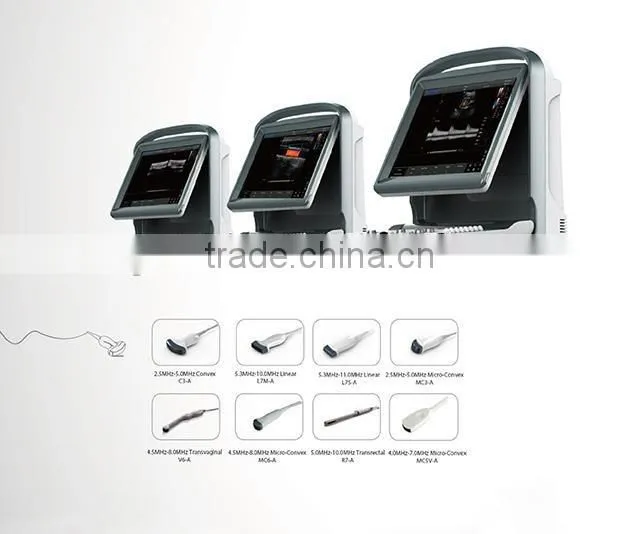 New Laptop 3D/4D Color Doppler Ultrasound System Ultrasound Color Doppler Portable