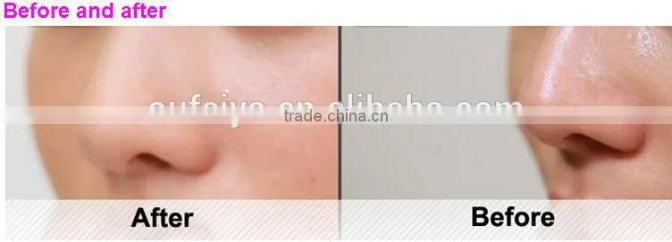 2016 new design skin beauty devices