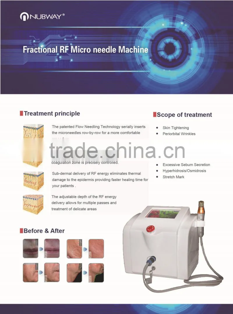 micro needle rf fractional