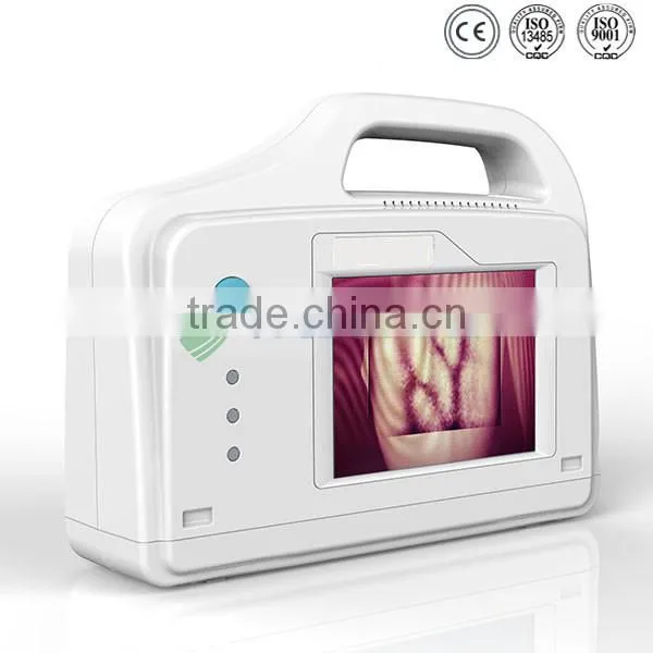 medical injection portable vein viewer price