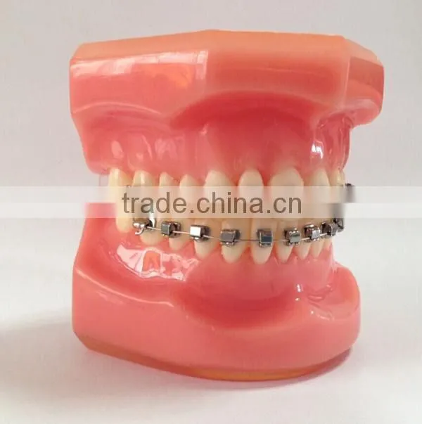 dental manufacturer Hot-sell ceramic red teeth orthodontic model
