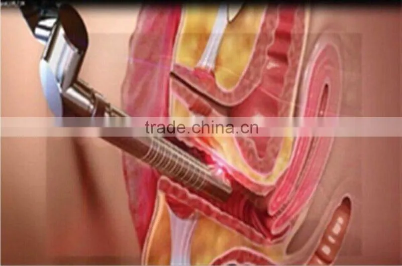 For skin resurfacing, vaginal tightening rf fractional co2 laser