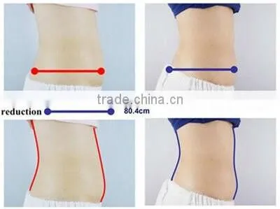 Professional beauty machine criotherapy weight loss machine popular in the world