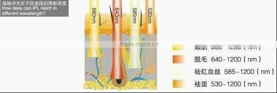 big speckle IPL facial hair removal equipment