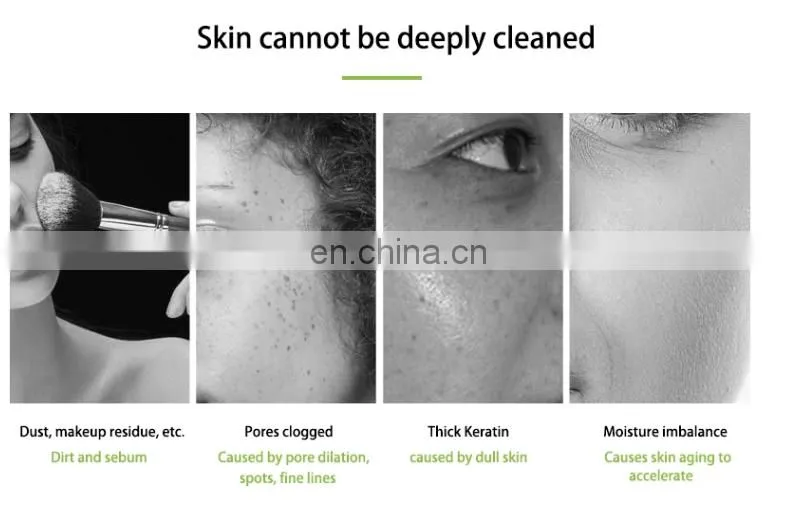 Portable Mini Face Cleaning Hydra Dermabrasion Aqua Peel Facial Machine Cleaning Blackheads For Home Use
