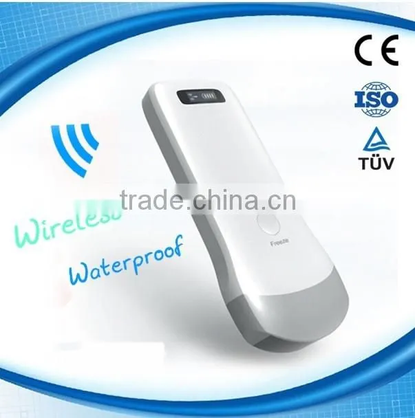UltraSound Scanner, Convex Probe Ultrasound Scanner, WiFi, 3.5MHz / R40 / 64 Elements, SIFULTRAS-5.1