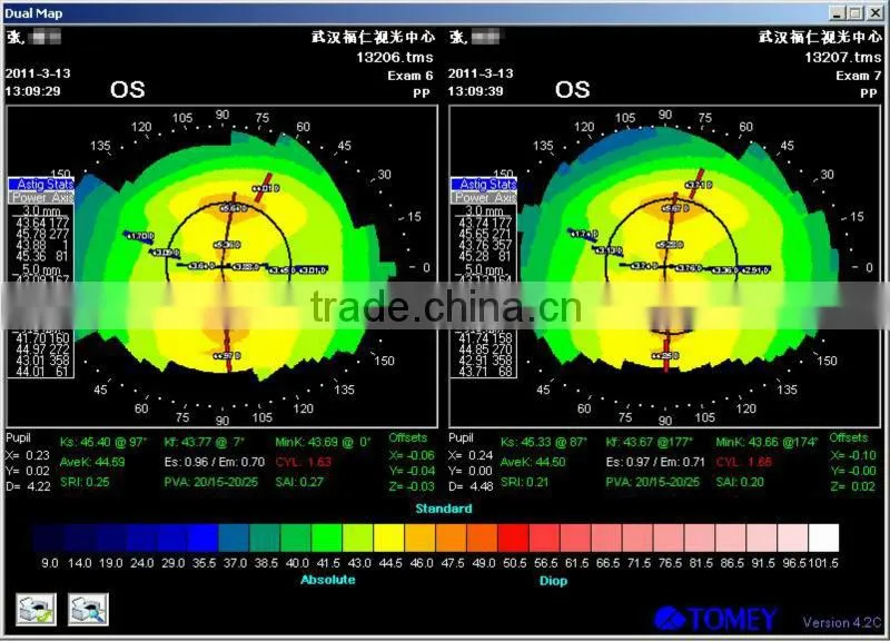 MCT Hard lens For low myopia/MCT lenses/no operation treat myopia,make your eyes normal