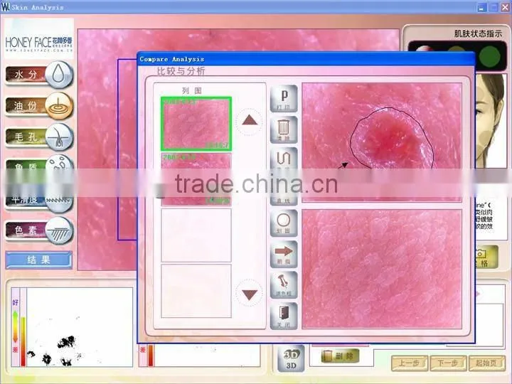 2013 Beauty salon/home use touch screen beauty care equipment skin diagnosis purpose BD-P006