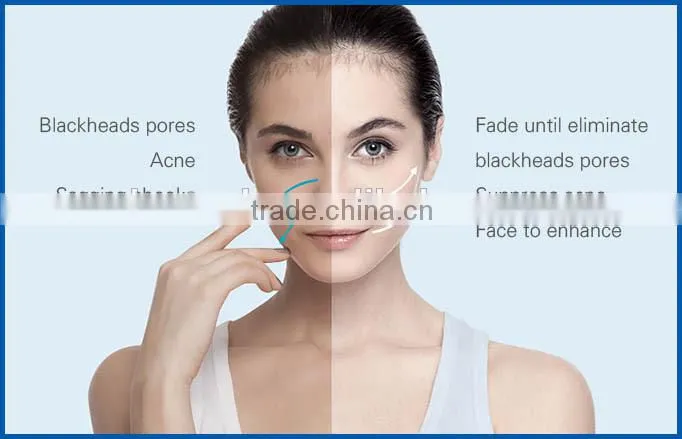 Economical and popular hair removal device