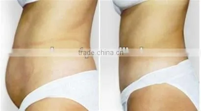 Innovation!! cavitation ultrasound machine 2012 for fat burning F019