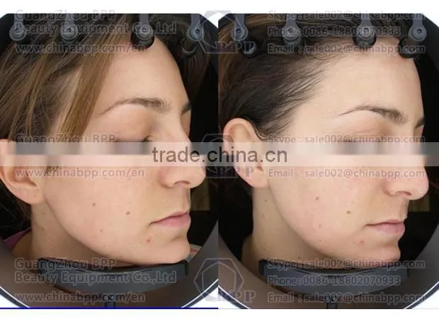 RGB and UV spectrum skin analysis camera for analysis skin characteristic