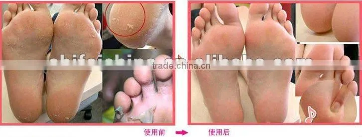 Eilovy new effective exfoliating foot mask