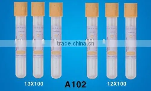 sodium fluoride/potassium oxalate tube