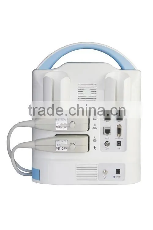 hospital Equipment laptop ultrasound machine/portable ultrasound scanner KX5600