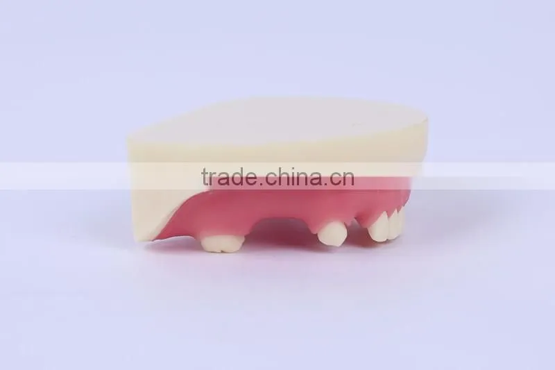 Trade Assurance Hot Dental Implant System CE Approved Dental Implant Model