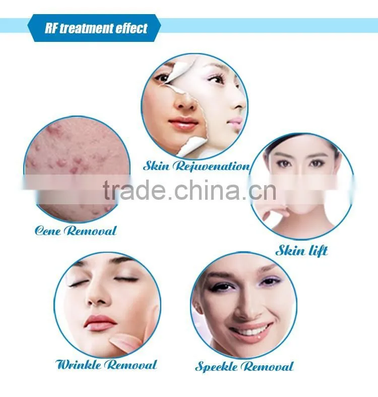 2016 Hot 5 treatment handles cavitation weight loss slimming