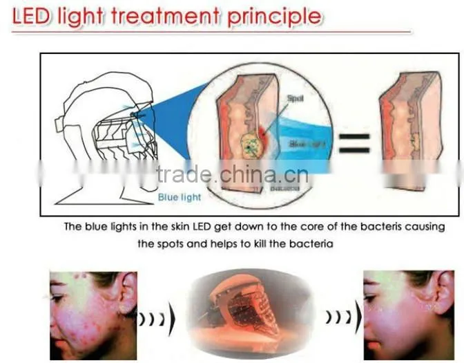 High Quality LN-M5 Skin Care LED Light Mask for Wrinkle Remover